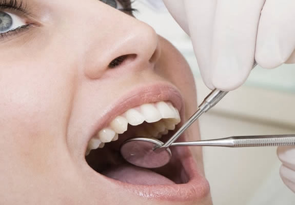 Les aligneurs dentaires, cette mode dangereuse qui court-circuite les  orthodontistes