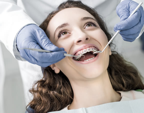 Orthodontie ado et adulte : Corriger l'alignement dents définitives - Dr  Gilbert