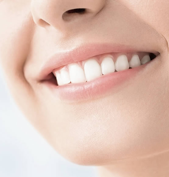 Blanchiment dentaire : y a-t-il des risques associés ?
