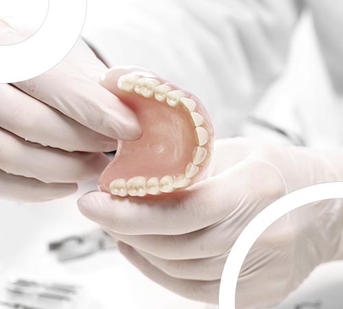 Différences entre implant, couronne, bridge, pivot et appareil dentaire